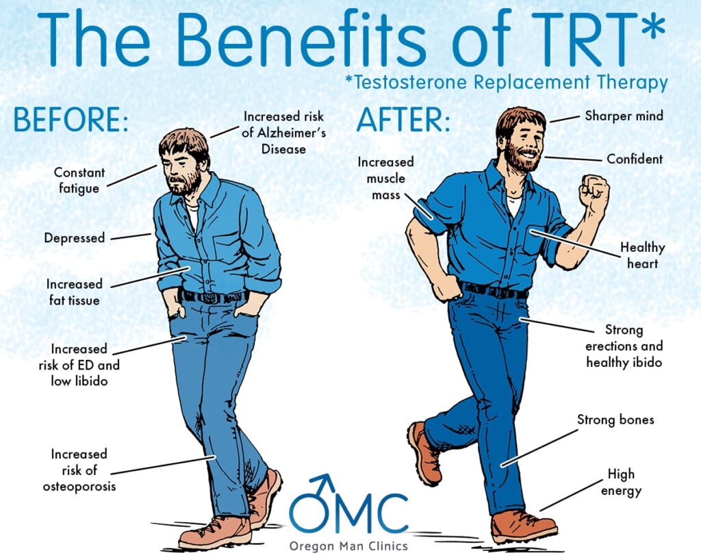 before after t omc 1 before after t omc 1 (1)