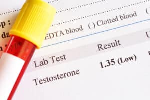Testosterone screening results